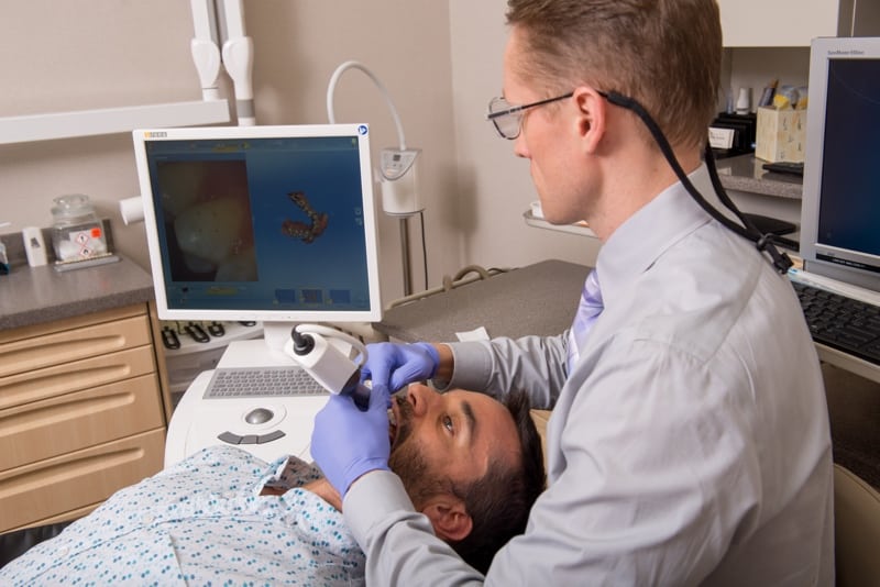 CEREC 3D teeth scanning