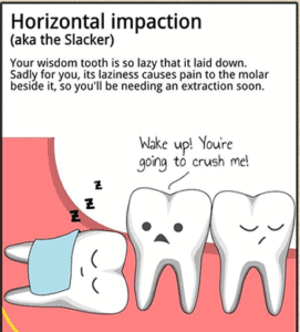 wisdom teeth sarasota