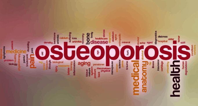 osteoporosis dental health