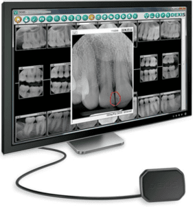 digital dental x-rays