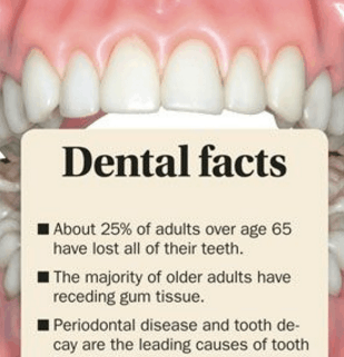 teeth cleaning sarasota