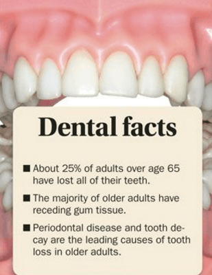 teeth cleaning sarasota