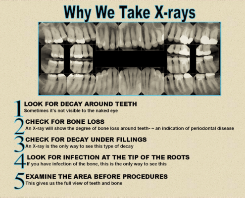 digital dental xrays sarasota