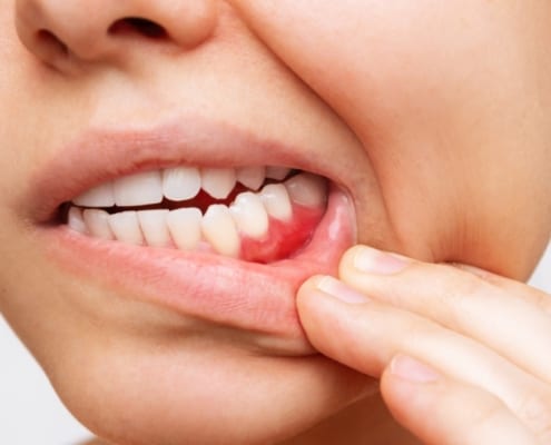 can gums grow back