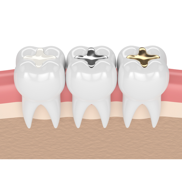 teeth with gold, amalgam and composite fillings